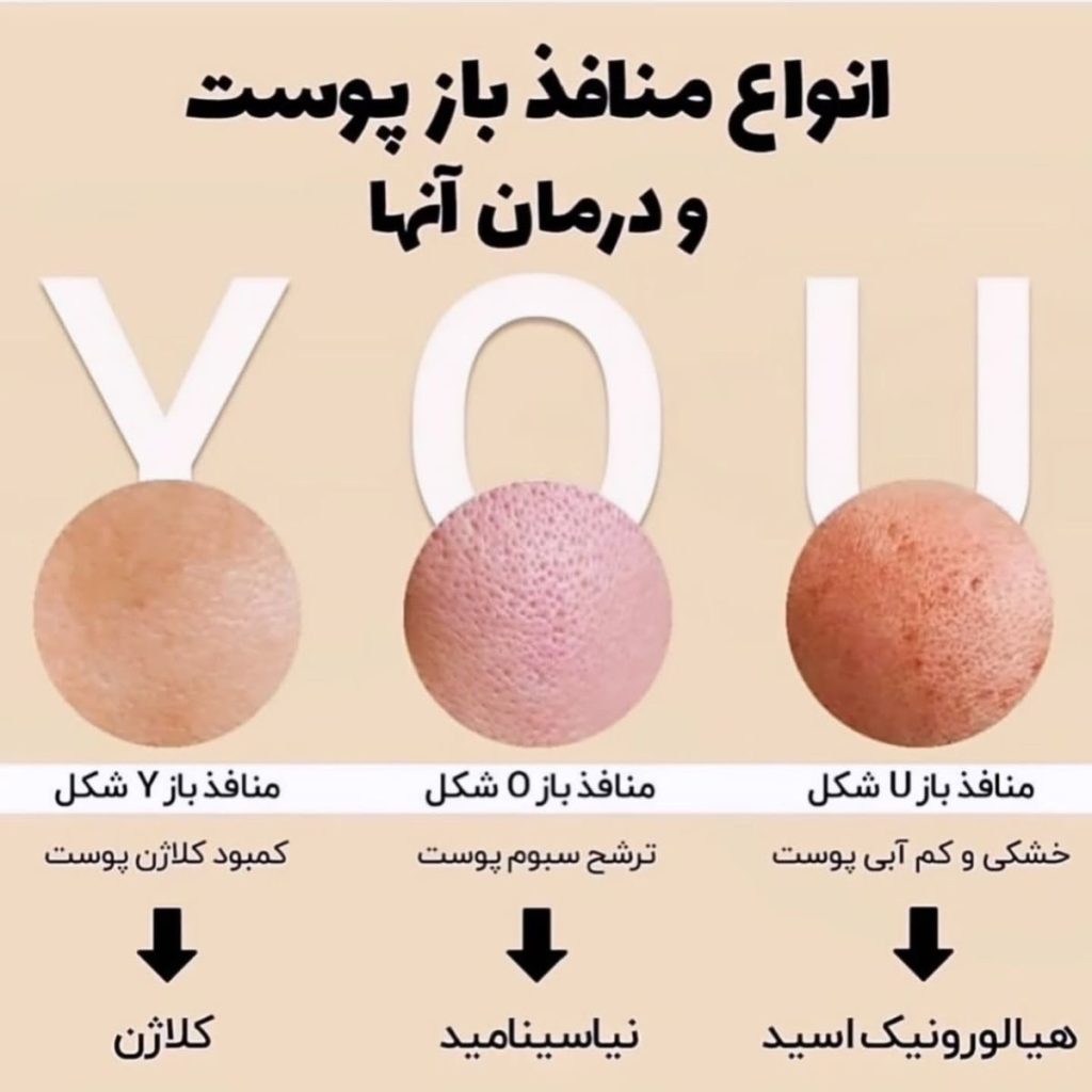 `منافذ پوستت چه شکلیه؟ U، O یا Y؟ (راهنمای کامل درمان انواع منافذ) - آریحل|نمایندگی محصولات تراست`